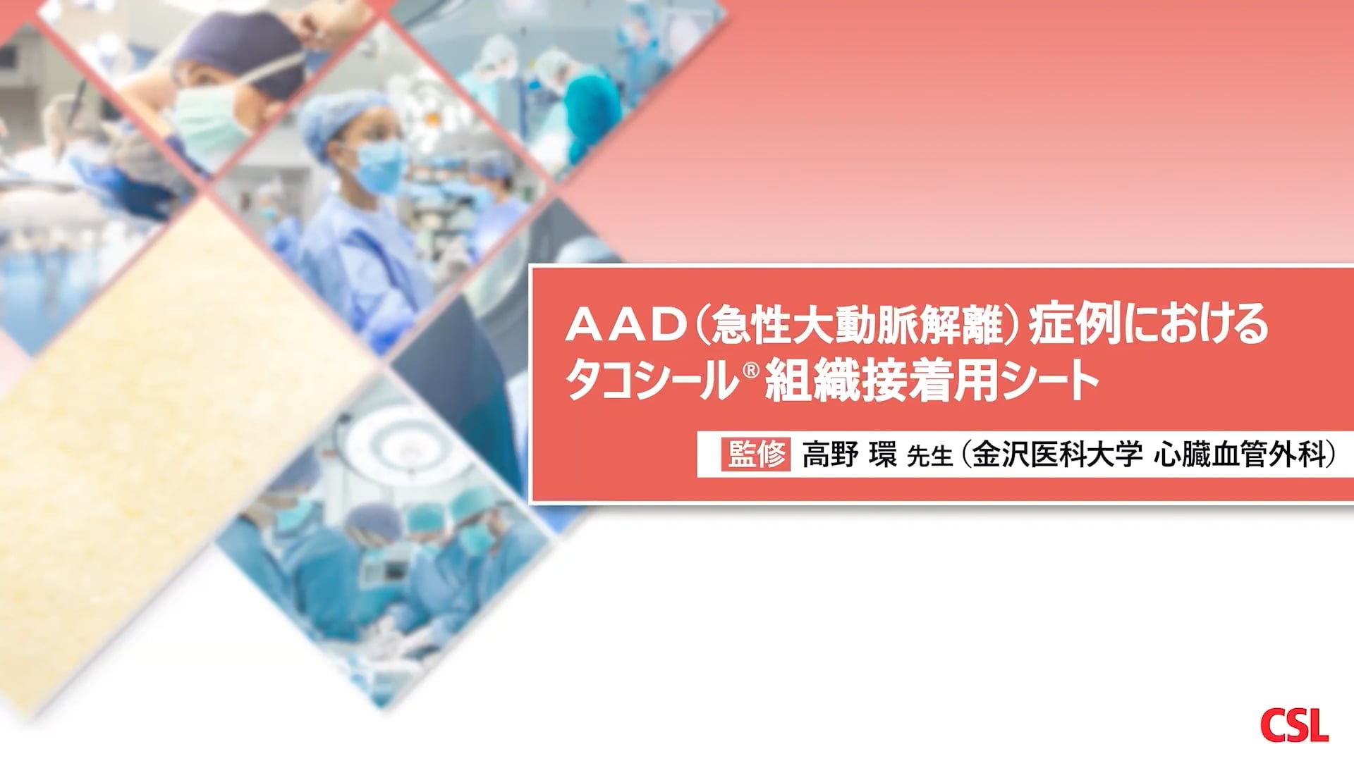 AAD（急性大動脈解離）症例におけるタコシール組織接着用シート