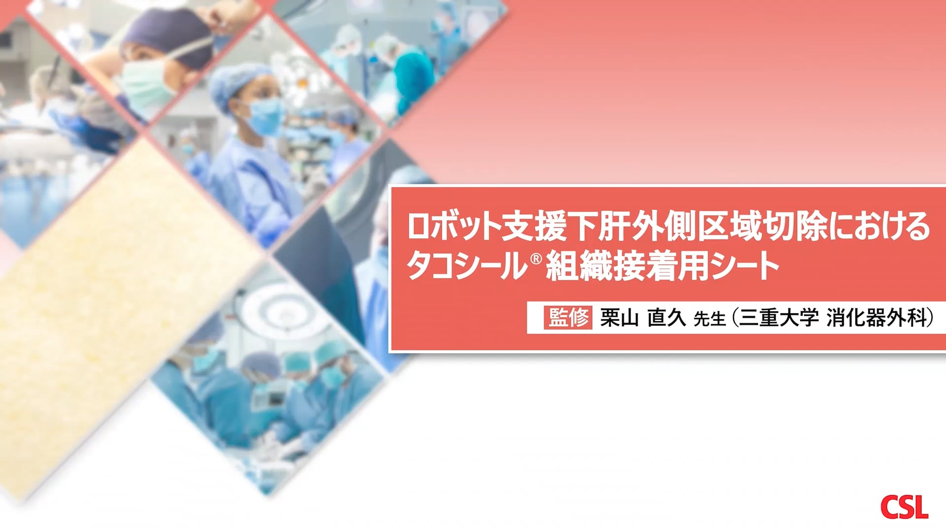 ロボット支援下肝外側区域切除におけるタコシール組織接着用シート
