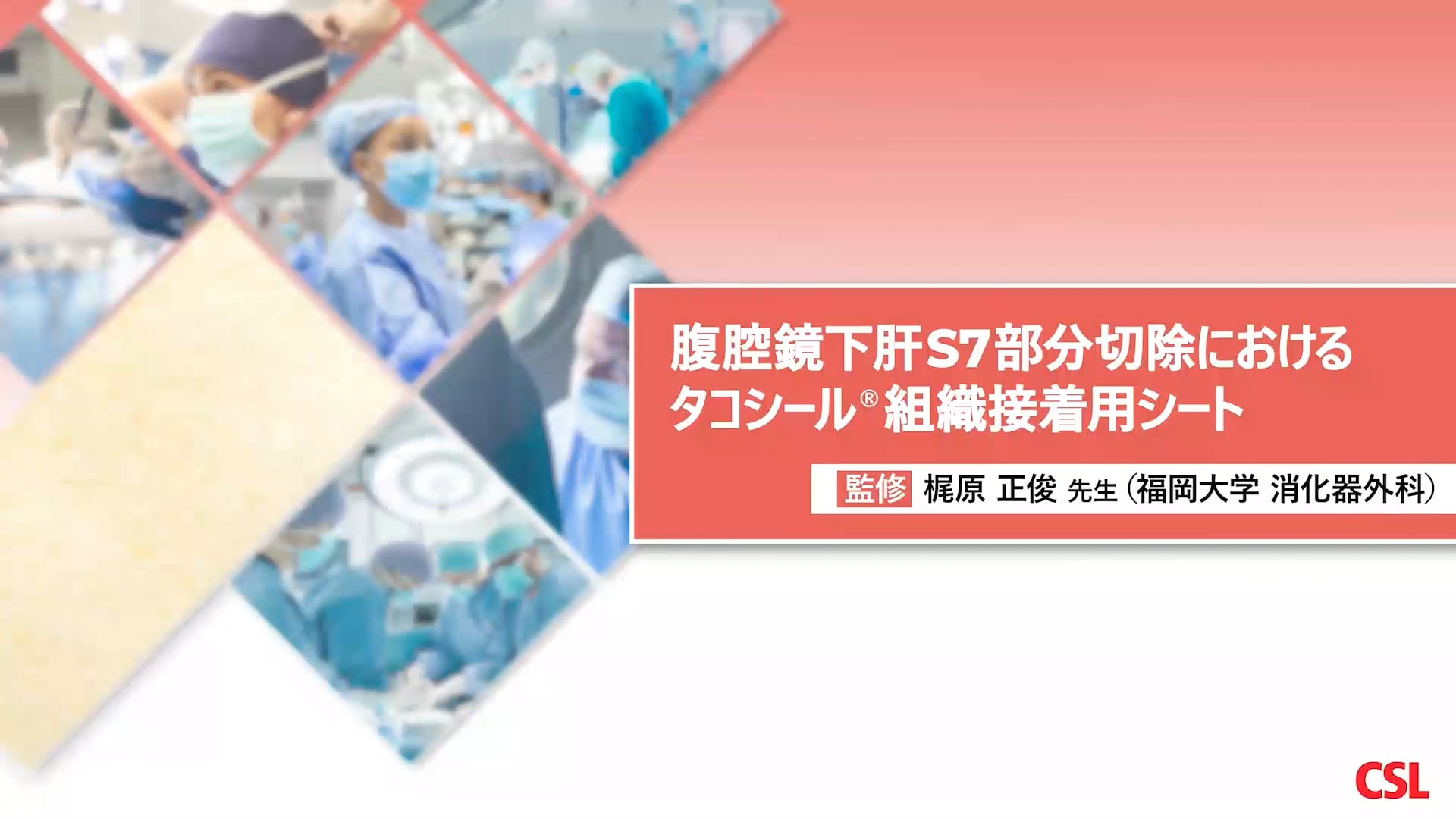 腹腔鏡下肝S7部分切除におけるタコシール組織接着用シート